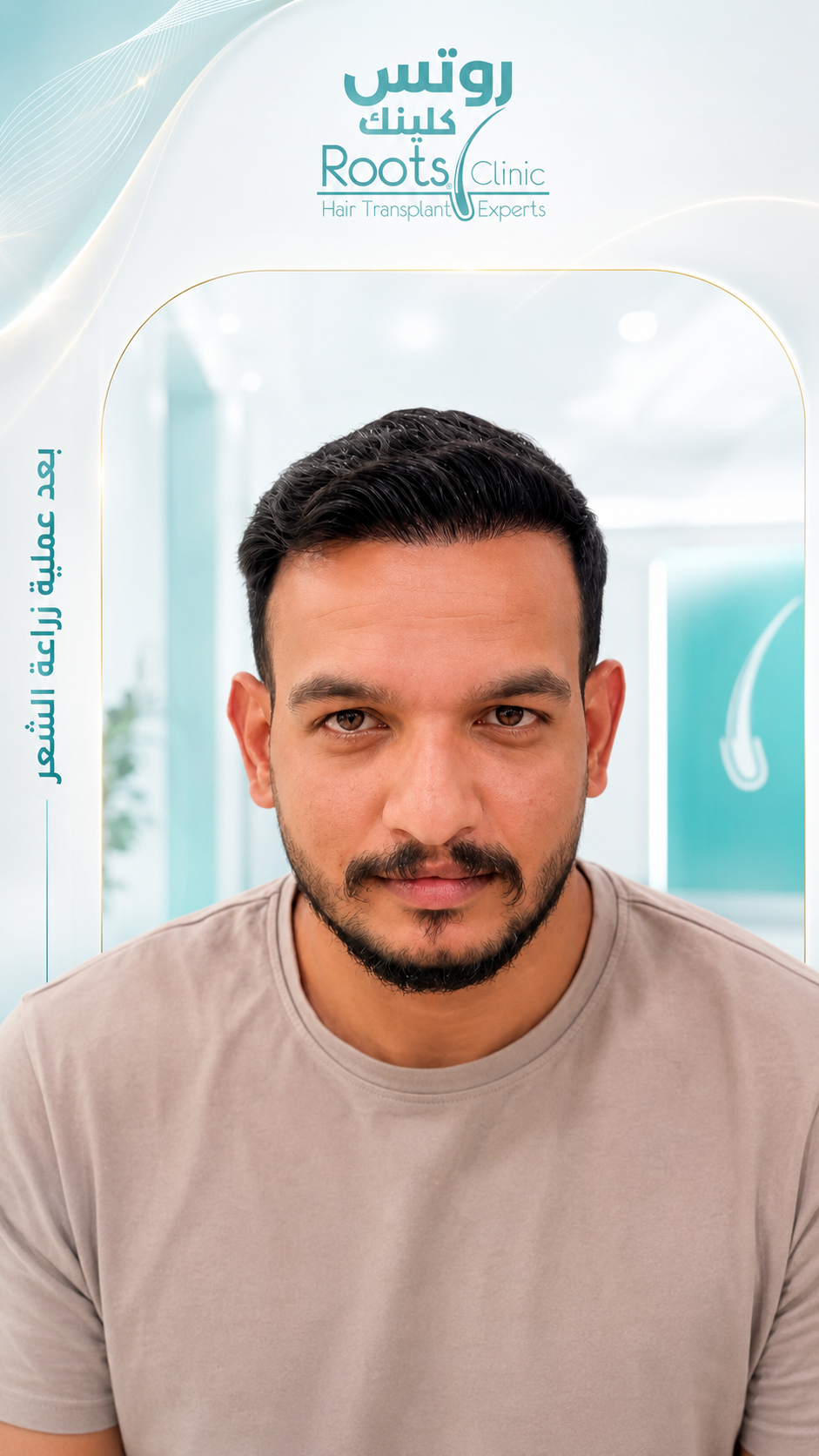 بعد زراعة خط المقدمة
